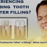 how_to_relieve_tooth_pain_after_filling_edited