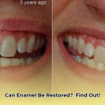 how_to_restore_tooth_enamel_naturally_edited