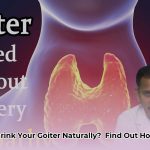 how_to_shrink_a_goiter_naturally_edited