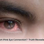 can_you_get_pink_eye_from_a_fart_edited