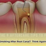 can_you_smoke_after_a_root_canal_edited