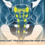 exercises_to_avoid_with_tarlov_cysts_edited