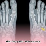 growth_plates_of_the_foot_edited