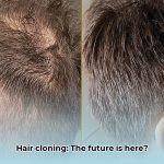 hair_cloning_edited