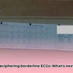 borderline_ecg_medical_terminology_edited